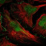 DONSON Polyclonal Antibody