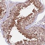 KLHL29 Antibody in Immunohistochemistry (Paraffin) (IHC (P))