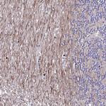 SAMD1 Antibody in Immunohistochemistry (Paraffin) (IHC (P))
