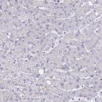 SAMD1 Antibody in Immunohistochemistry (Paraffin) (IHC (P))