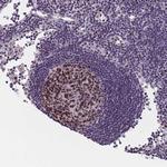 SAMD1 Polyclonal Antibody