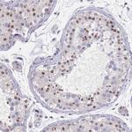 SAMD1 Antibody in Immunohistochemistry (Paraffin) (IHC (P))