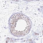 INO80C Antibody in Immunohistochemistry (IHC)