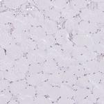 INO80C Antibody in Immunohistochemistry (IHC)
