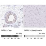 INO80C Antibody