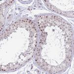 INO80C Antibody in Immunohistochemistry (IHC)
