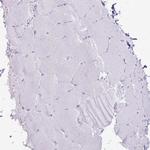 CNFN Antibody in Immunohistochemistry (Paraffin) (IHC (P))