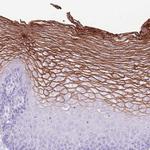 CNFN Antibody in Immunohistochemistry (IHC)