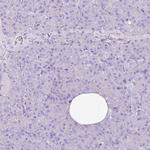 CNFN Antibody in Immunohistochemistry (IHC)