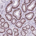 FAM104B Polyclonal Antibody