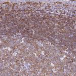Calponin 2 Antibody in Immunohistochemistry (Paraffin) (IHC (P))