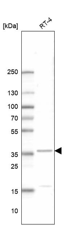 Calponin 2 Antibody in Western Blot (WB)