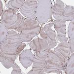 FMO4 Antibody in Immunohistochemistry (Paraffin) (IHC (P))