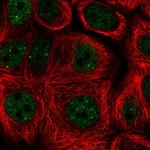 TLE2 Polyclonal Antibody