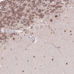 TLE2 Antibody in Immunohistochemistry (Paraffin) (IHC (P))