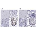 STAG3 Antibody in Immunohistochemistry (IHC)