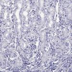 STAG3 Antibody in Immunohistochemistry (IHC)