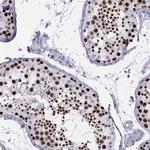 STAG3 Antibody in Immunohistochemistry (IHC)