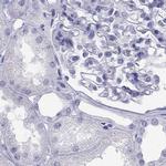 STAG3 Antibody in Immunohistochemistry (IHC)