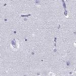STAG3 Antibody in Immunohistochemistry (IHC)