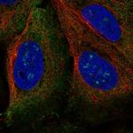 TRIM61 Antibody in Immunocytochemistry (ICC/IF)