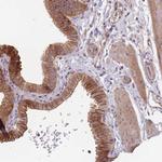 OR4C3 Polyclonal Antibody