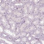SLC1A7 Antibody in Immunohistochemistry (Paraffin) (IHC (P))