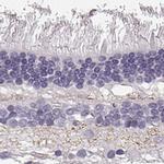 SLC1A7 Antibody in Immunohistochemistry (IHC)