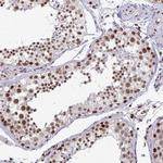 WBP11 Antibody in Immunohistochemistry (Paraffin) (IHC (P))
