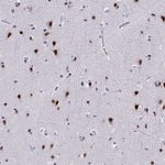 WBP11 Antibody in Immunohistochemistry (Paraffin) (IHC (P))