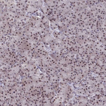 WBP11 Antibody in Immunohistochemistry (Paraffin) (IHC (P))