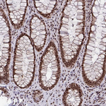 WBP11 Antibody in Immunohistochemistry (Paraffin) (IHC (P))