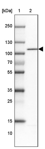 WBP11 Antibody in Western Blot (WB)