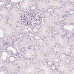 FAM55A Antibody in Immunohistochemistry (Paraffin) (IHC (P))
