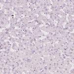 FAM55A Antibody in Immunohistochemistry (IHC)