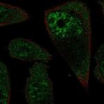 RPL3L Polyclonal Antibody