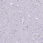 RPL3L Antibody in Immunohistochemistry (Paraffin) (IHC (P))