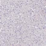 RPL3L Antibody in Immunohistochemistry (Paraffin) (IHC (P))