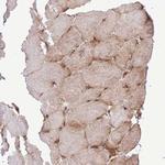 RPL3L Antibody in Immunohistochemistry (Paraffin) (IHC (P))