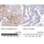 RPL3L Antibody in Immunohistochemistry (IHC)