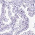 RPL3L Antibody in Immunohistochemistry (IHC)