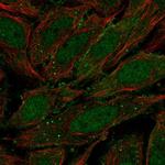 ZNF510 Polyclonal Antibody
