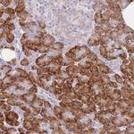 ZNF510 Antibody in Immunohistochemistry (Paraffin) (IHC (P))