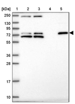 ZNF510 Antibody in Western Blot (WB)