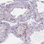 ZKSCAN2 Antibody in Immunohistochemistry (Paraffin) (IHC (P))