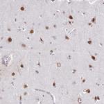 DPF1 Antibody in Immunohistochemistry (Paraffin) (IHC (P))