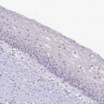 DPF1 Antibody in Immunohistochemistry (Paraffin) (IHC (P))