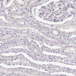 DPF1 Antibody in Immunohistochemistry (Paraffin) (IHC (P))