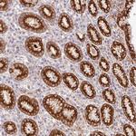 RELM beta Polyclonal Antibody