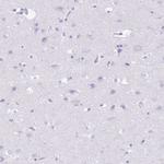 TPSB2 Antibody in Immunohistochemistry (Paraffin) (IHC (P))